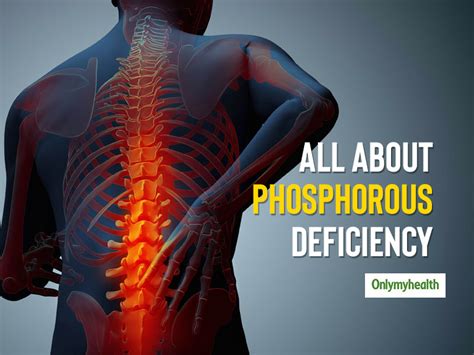 Phosphorus Deficiency Know The Causes Symptoms And Health Problems