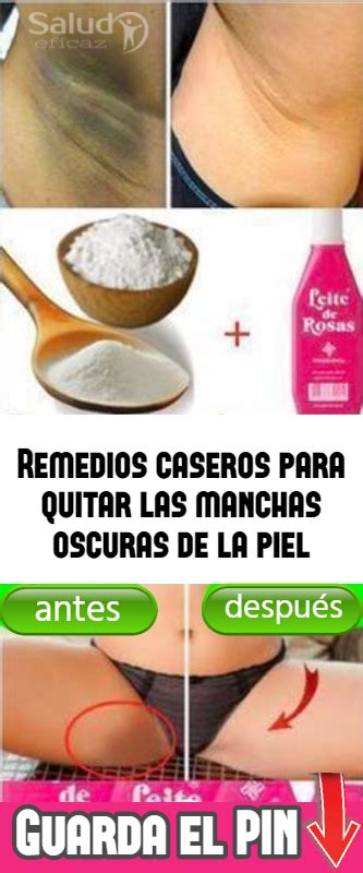 The Best Skin Care Products Quitar Manchas Entrepierna Manchas