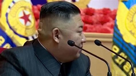 North Korea Kim Jong Un Seen With Plaster On Back Of Head World News Sky News