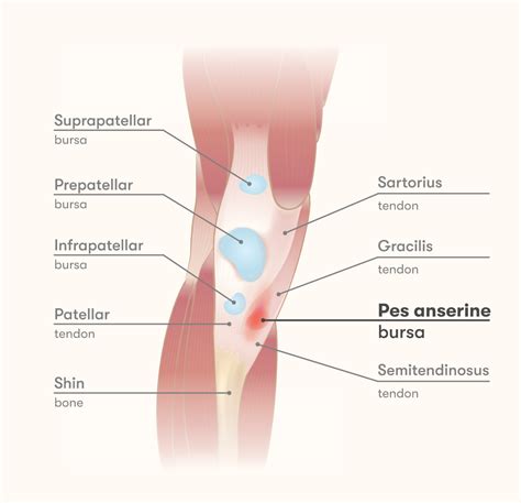 Pes Anserine Bursitis Causes And Best Treatment Options In Porn