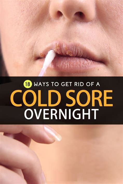 Famous How To Hide A Cold Sore Under Nose References Pressly