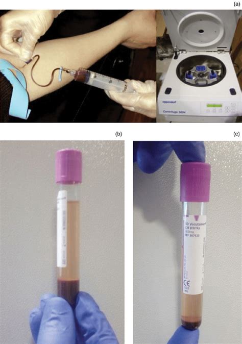 Photographs Showing A Blood Sampling And Centrifugation Apparatus