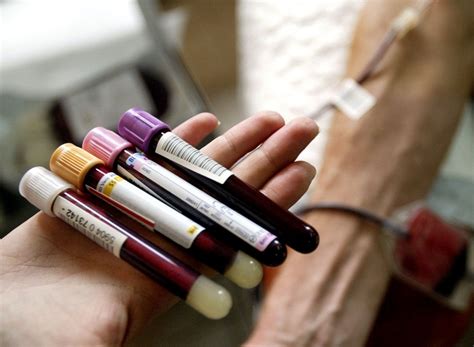 Routine Blood Tests Nursing Times
