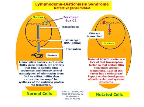 Lymphedema Distichiasis Syndrome Hereditary Ocular Diseases