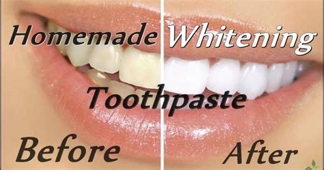 Homemade Whitening Toothpaste Recipe Beauty4everything3