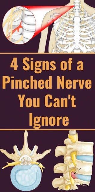 4 Crucial Signs Of A Pinched Nerve You Really Should’t Ignore Medium