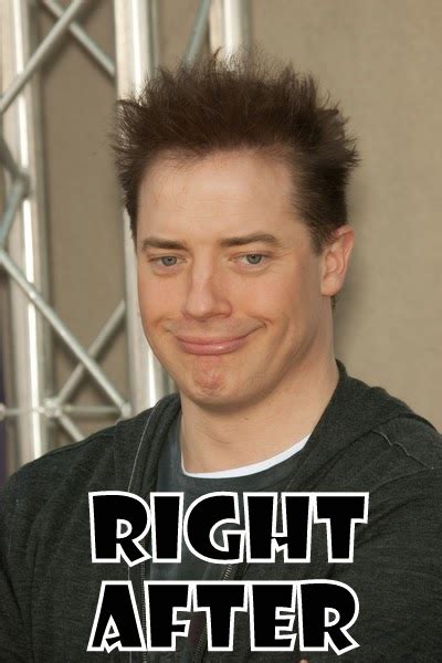 Has Brendan Fraser Hair Transplants Plastic Surgery Before And After Images