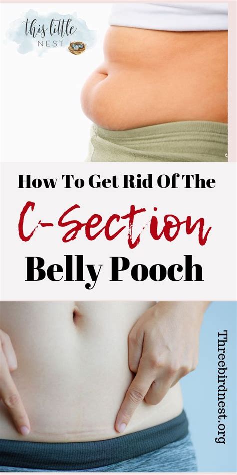 How To Get Rid Of Mom Pouch After C Section Addlemanfaruolo