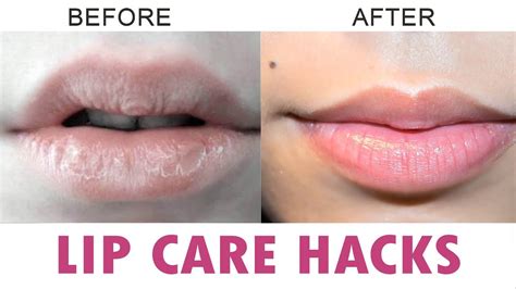 How To Get Rid Of Dry Lips In Winter Season SaySwag YouTube