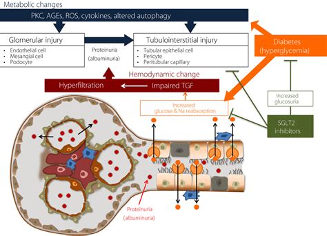 In the diabetes community, kidney disease is a major focus. Diabetic kidney disease: Its current trends and future ...