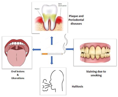 ijerph free full text smoking a dangerous addiction a systematic review on an underrated