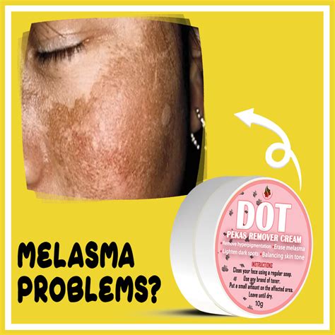 Buy 1 Take 1 Melasma And Dark Spot Remover By Elegant Dot Pekas Remover