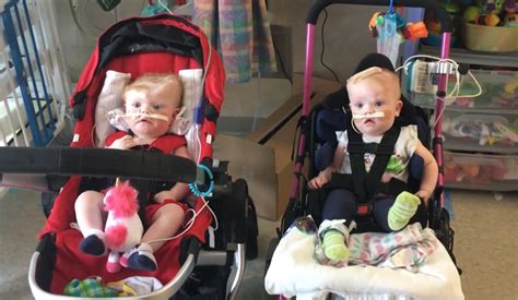 Recently Separated Conjoined Twins Getting Ready To Go Home Cbs News
