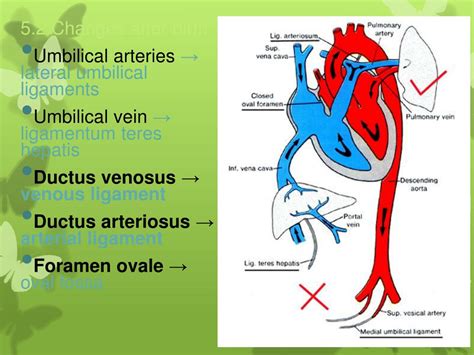 Ductus Arteriosus Vs Ductus Venosus Vs Foramen Ovale