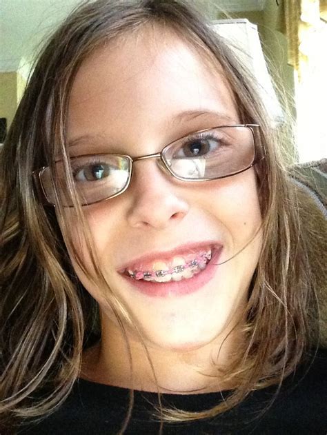 Braces And Glasses What A Cutie Pie Braces And