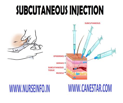 Subcutaneous Injection Purpose General Instruction Responsibility