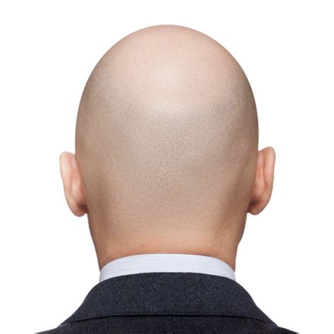 Bald Head Stock Photos Royalty Free Bald Head Images Depositphotos®