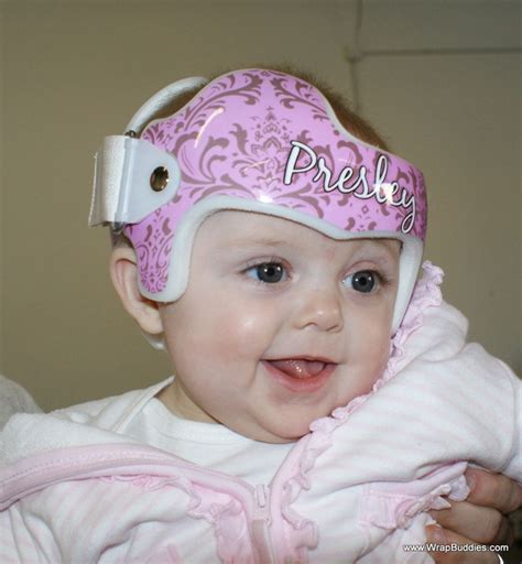 Plagiocephaly Torticollis Doc Band Baby Helmet Decoration