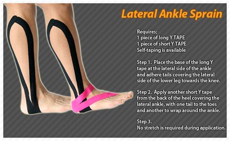 Aresports Sprained Ankle Kinesiology Taping Kinesio Taping