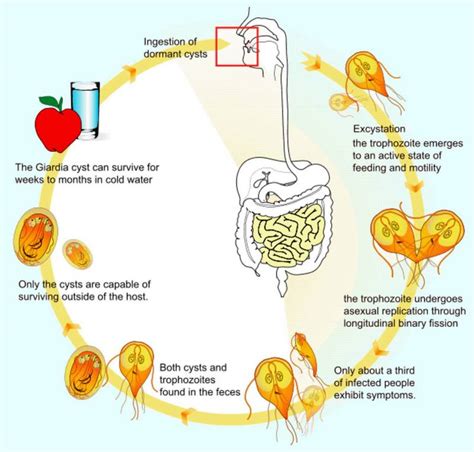 Giardiasis A Cause Of Chronic Diarrhea And Malabsorption Medchrome