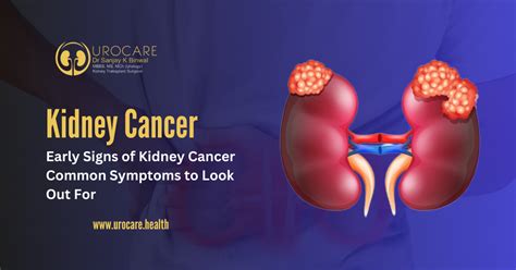 Early Signs Of Kidney Cancer Common Symptoms To Look Out For