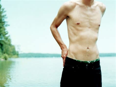 Male Anorexia On The Rise Body Soul