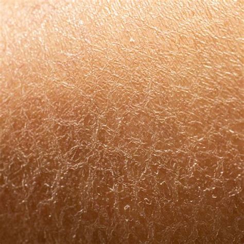 How To Treat Dehydrated Skin Combat Flaking Tightness And Dry Skin