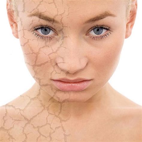 Dry Skin 6 Ways To Treat It