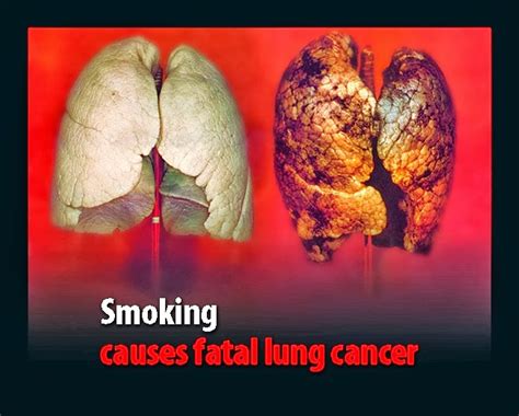 Atas dasar kesemua sumber negatif ini, berikut disenaraikan 8 jenis penyakit kronik yang berkaitan dengan sistem respirasi manusia reaksi ini melibatkan simptom yang pelbagai termasuk resdung dan rhinitis; 4 Penyakit Sistem Respirasi