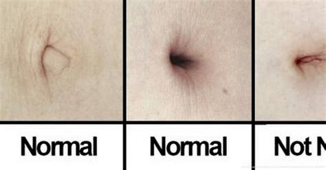 10 Strange Things You Probably Didnt Know About Your Belly Button