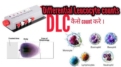 Dlc Test Differential Leukocyte Count R D Medical Science Dlc Wbc