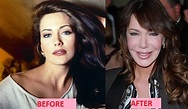 Hunter Tylo's Plastic Surgery - Looks Completely Different!