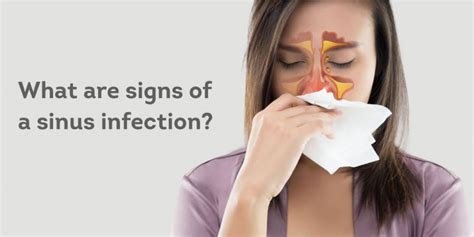 What Are The Signs Of A Sinus Infections
