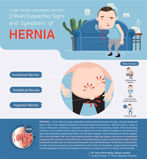 Hernias Types Symptoms And When To Seek Urgent Care