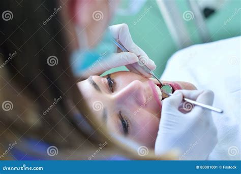 Close Up Of Female With Open Mouth During Oral Checkup At The Dentist