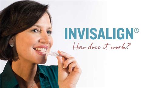 What Is Invisalign® And How Does It Work Tw Orthodontics