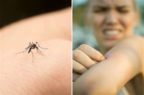 Can You Develop Immunity To Mosquito Bites