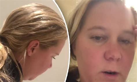 Amy Schumer Shares Video Of Herself Vomiting Due To Morning Sickness