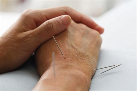 Acupuncture In Melbourne Can Be A Good Option For A Variety Of Health