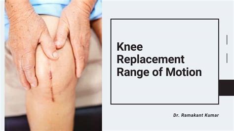 This article shares my range of motion progress after total knee replacement surgery as well as my timeline and range of motion goals. Knee Replacement Range of Motion | Knee Range of Motion Chart