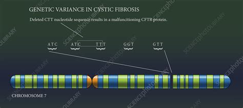 Cystic Fibrosis Chromosome Illustration Stock Image C