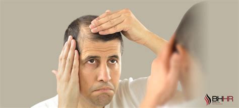 7 Ways To Prevent Hair Loss Beverly Hills Hair Restoration