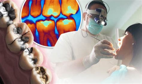 Is Food Making Your Teeth Enamel Scraping Away Dr Nechupadam