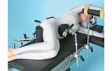 Medical Positioning Equipment Images