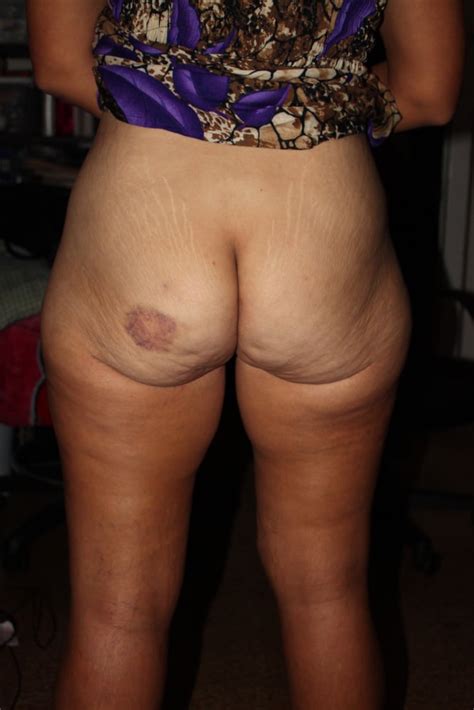Big Saggy Tits Wide Hips Big Ass Latina Milf Melissa Pics XHamster
