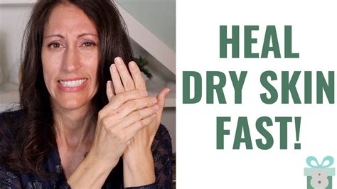 How To Heal Dry Cracked Hands And Heels Naturally 3 Easy Cold Weather