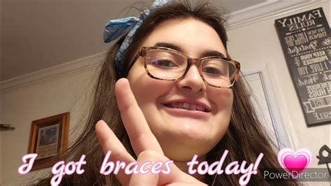 I Got Braces Today 💗 Youtube