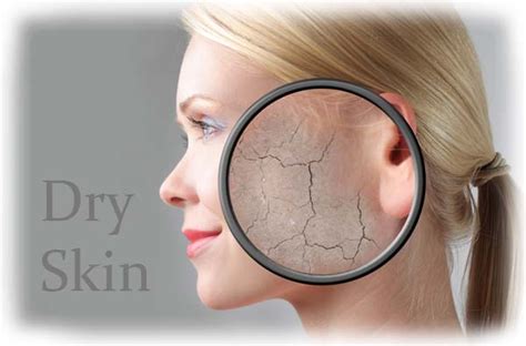 Dry Skin Symptoms Causes And Treatment