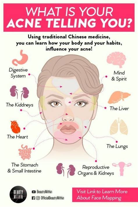 7 Most Susceptible Pimple Breakout Points And Why Beauty Skin Care Routine Acne Skin Skin
