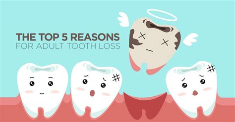 The Top 5 Reasons For Adult Tooth Loss